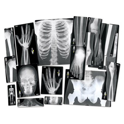 X-Rays
